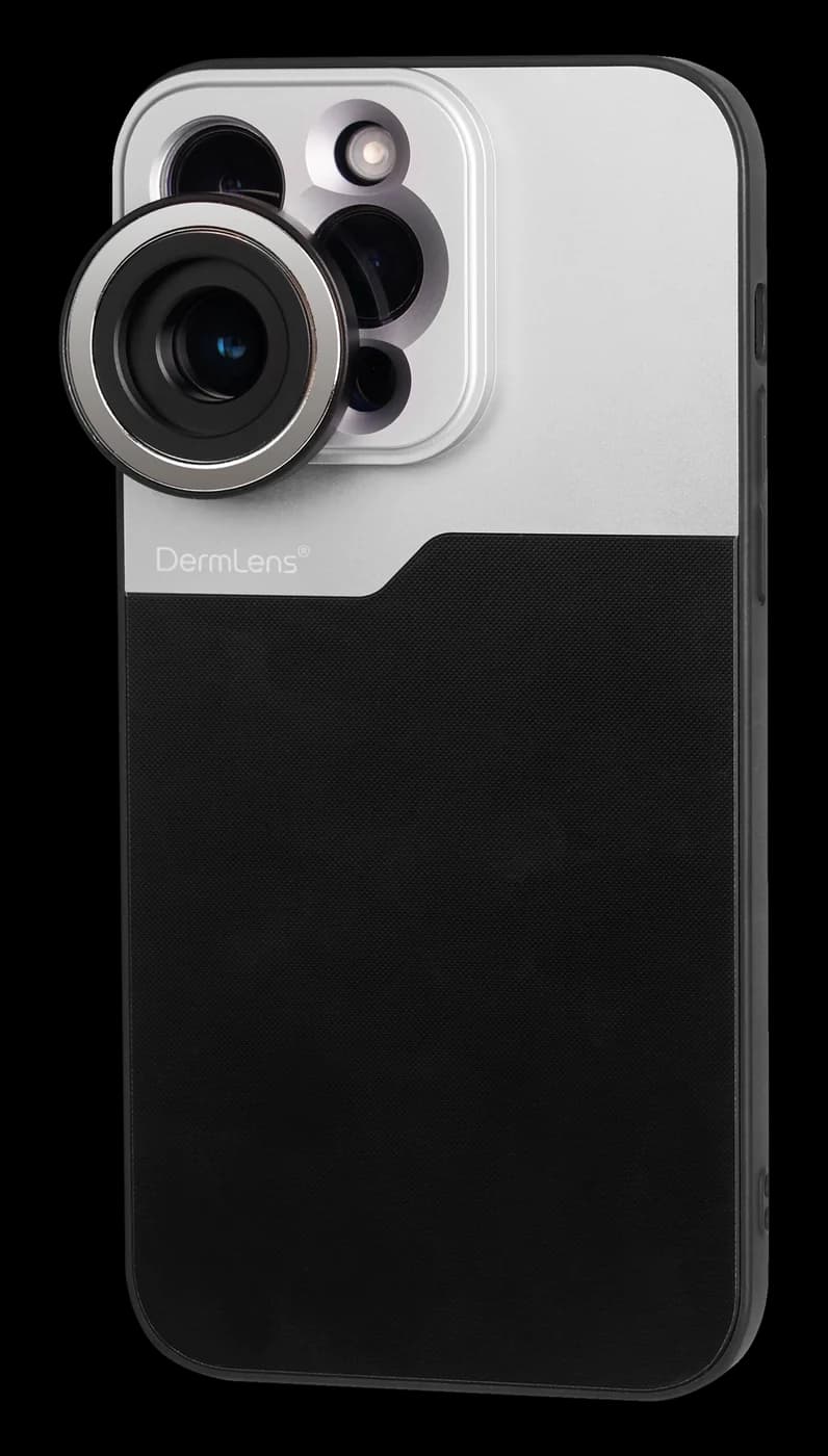 Dedicated DermLens phone case with the M6 snapped into position