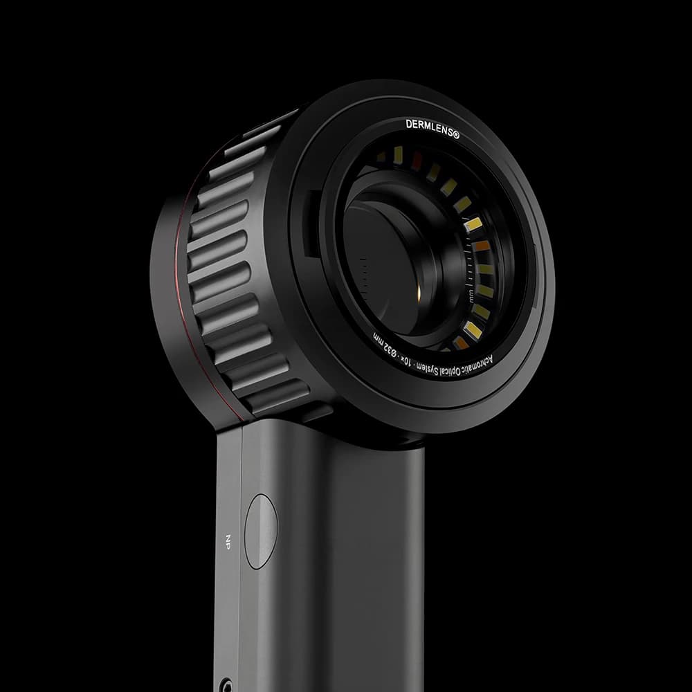 DermLens M6 dermatoscope, lens facing the viewer with its amber illumination ring lit